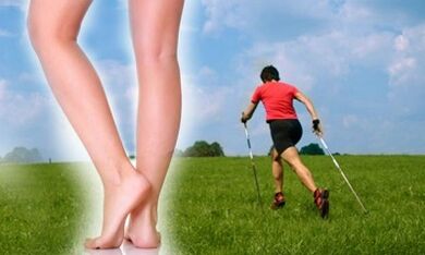 Permitted walking types for varicose veins